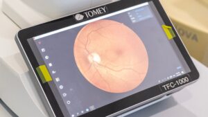 Saúde Visual | Glaucoma